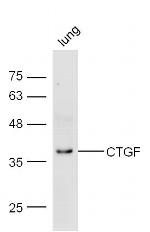 CTGF Antibody in Western Blot (WB)