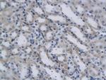 CD4 Antibody in Immunohistochemistry (Paraffin) (IHC (P))