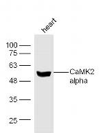 CaMK2 Antibody in Western Blot (WB)