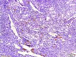 ECM1 Antibody in Immunohistochemistry (Paraffin) (IHC (P))