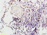 FABP2 Antibody in Immunohistochemistry (Paraffin) (IHC (P))