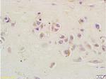 RSL1D1 Antibody in Immunohistochemistry (Paraffin) (IHC (P))