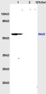 RSL1D1 Antibody in Western Blot (WB)