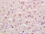 CD56 Antibody in Immunohistochemistry (Paraffin) (IHC (P))