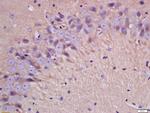 IL-1 Beta Antibody in Immunohistochemistry (Paraffin) (IHC (P))