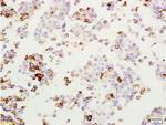 MAGE-1 Antibody in Immunohistochemistry (Paraffin) (IHC (P))