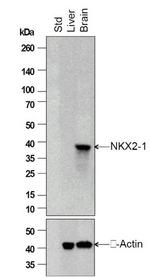 TTF-1 Antibody in Western Blot (WB)