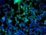 VE Cadherin Antibody in Immunocytochemistry (ICC/IF)