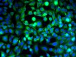 VE Cadherin Antibody in Immunocytochemistry (ICC/IF)