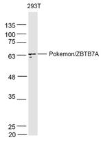 Pokemon Antibody in Western Blot (WB)