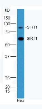 SIRT1 Antibody in Western Blot (WB)