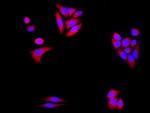 Alpha-Synuclein Antibody in Immunocytochemistry (ICC/IF)