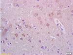 Alpha-Synuclein Antibody in Immunohistochemistry (Paraffin) (IHC (P))