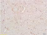 CD38 Antibody in Immunohistochemistry (Paraffin) (IHC (P))