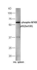 Phospho-NFKB p65 (Ser536) Antibody in Western Blot (WB)