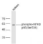 Phospho-NFKB p65 (Ser536) Antibody in Western Blot (WB)