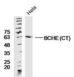 BCHE CT Antibody in Western Blot (WB)