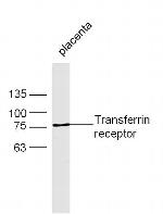 Transferrin receptor Antibody in Western Blot (WB)