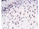 EphB2 Antibody in Immunohistochemistry (Paraffin) (IHC (P))