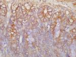 c-Kit Antibody in Immunohistochemistry (Paraffin) (IHC (P))