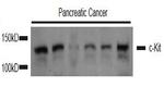 c-Kit Antibody in Western Blot (WB)