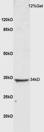 CTLA4 Antibody in Western Blot (WB)