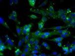 E cadherin Antibody in Immunocytochemistry (ICC/IF)