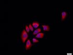 E cadherin Antibody in Immunocytochemistry (ICC/IF)