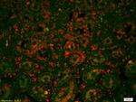 E cadherin Antibody in Immunohistochemistry (Paraffin) (IHC (P))