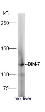 DIM-7 Antibody in Western Blot (WB)