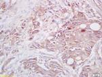 CIAS1 Antibody in Immunohistochemistry (Paraffin) (IHC (P))