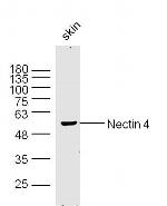 Nectin 4 Antibody in Western Blot (WB)