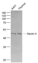 Nectin 4 Antibody in Western Blot (WB)