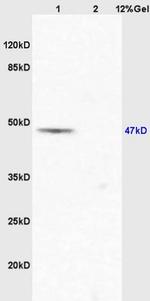 EIF5 Antibody in Western Blot (WB)