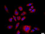 NFKB p100/p52 Antibody in Immunocytochemistry (ICC/IF)