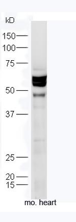 TXA2R Antibody in Western Blot (WB)