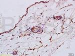 CK4 Antibody in Immunohistochemistry (Paraffin) (IHC (P))