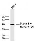 DRD1 Antibody in Western Blot (WB)