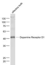 DRD1 Antibody in Western Blot (WB)