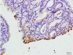 CXCR1 Antibody in Immunohistochemistry (Paraffin) (IHC (P))