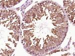 HSP90 alpha Antibody in Immunohistochemistry (Paraffin) (IHC (P))