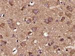 Phospho-Tau protein (Ser579) Antibody in Immunohistochemistry (Paraffin) (IHC (P))