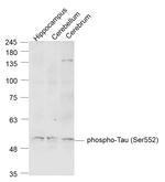 Phospho-Tau protein (Ser552) Antibody in Western Blot (WB)