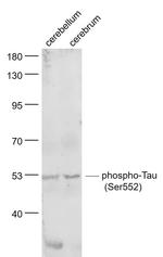 Phospho-Tau protein (Ser552) Antibody in Western Blot (WB)