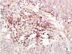 CXCR4 Antibody in Immunohistochemistry (Paraffin) (IHC (P))