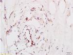 CXCR4 Antibody in Immunohistochemistry (Paraffin) (IHC (P))