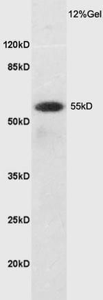 SLC7A5 Antibody in Western Blot (WB)