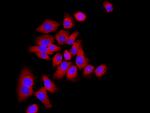 P21 Antibody in Immunocytochemistry (ICC/IF)