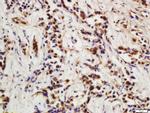 P21 Antibody in Immunohistochemistry (Paraffin) (IHC (P))