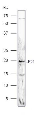 P21 Antibody in Western Blot (WB)